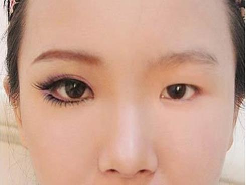 2 phút 'biến hình' đôi mắt một mí thành hai mí không cần dao kéo