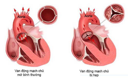 SHOCK: Hậu vệ Văn Thanh từng mắc bệnh nguy hiểm tính mạng, phải chạy chữa suốt 3 năm-4