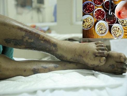 Uống rượu với những thực phẩm này dễ say, ngộ độc-4