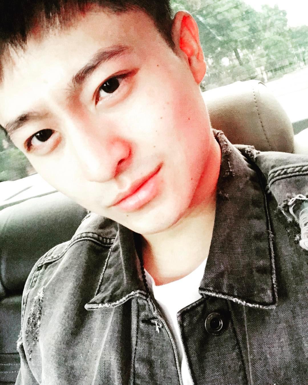 Harry Lu: đẹp trai ngời ngời một thời giờ khiến nhiều người không nhận ra sau phẫu thuật mũi-14