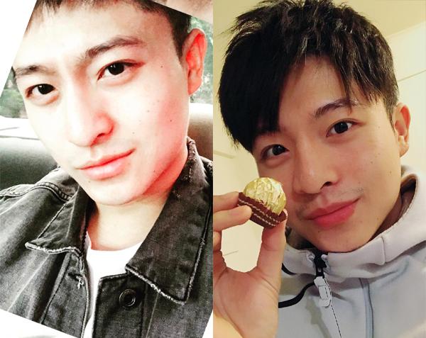 Harry Lu đã hoàn toàn khỏe mạnh sau 20 lần điều trị, phẫu thuật mũi, xương quai hàm, gò má-1