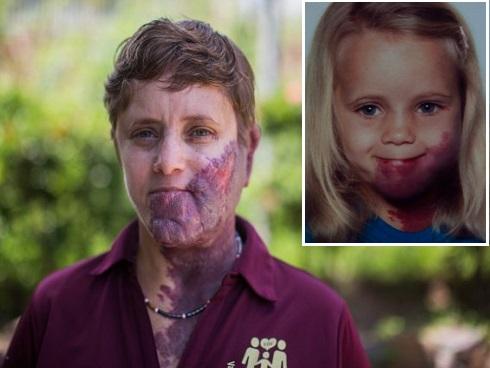 Bé gái 7 tuổi ở Hà Nội hiến giác mạc sau khi qua đời: Em nằm đó như một thiên thần-3