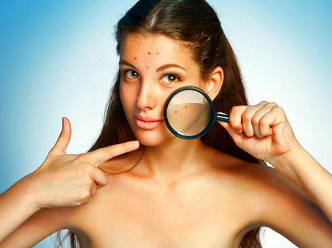 Mặt nạ táo cực tốt cho làn da của bạn-5