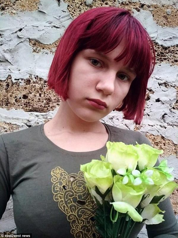 Thảm kịch trên đường đi học về, bé gái 12 tuổi bị bầy chó hoang tấn công dã man-1