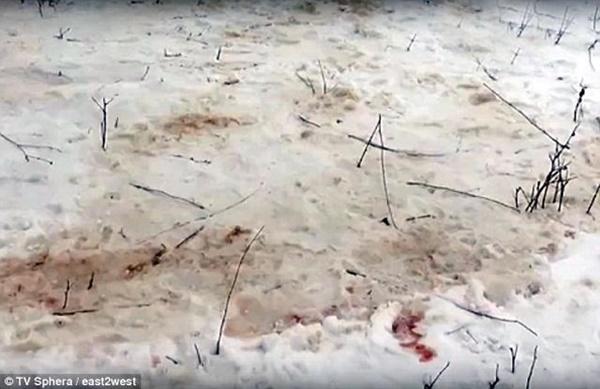 Thảm kịch trên đường đi học về, bé gái 12 tuổi bị bầy chó hoang tấn công dã man-2