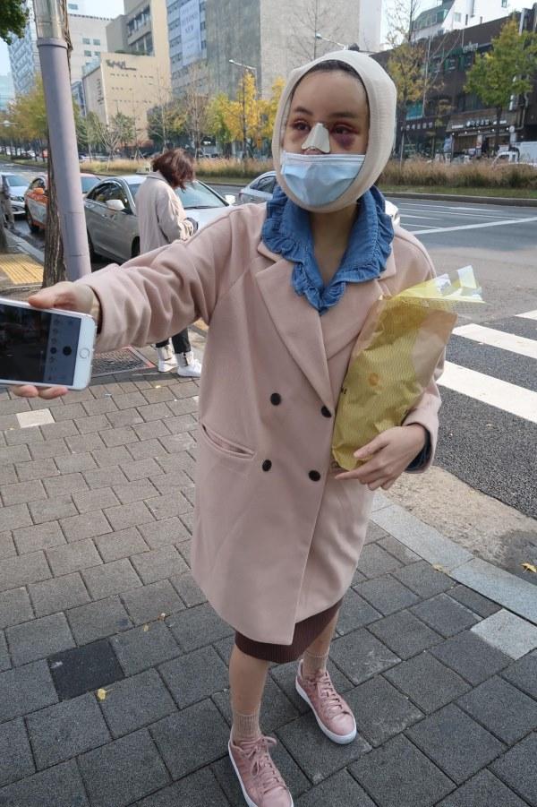 Chấp nhận đau đớn hàng tháng trời, cô gái từ vịt thành thiên nga-5