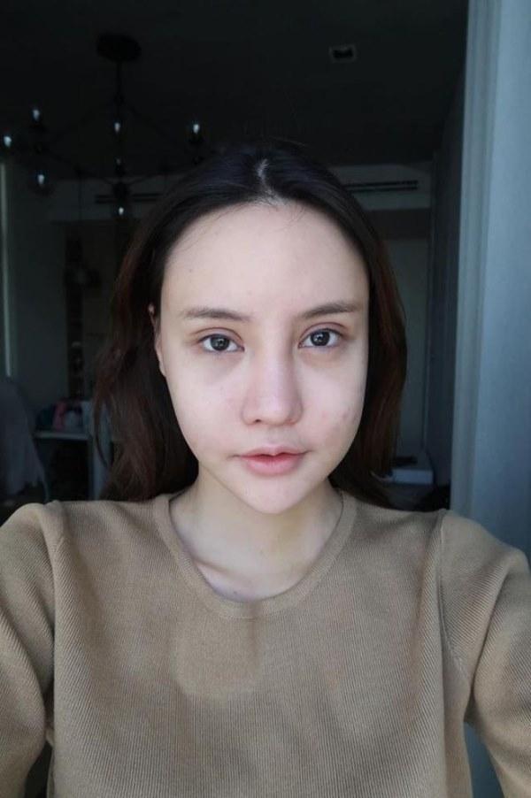 Chấp nhận đau đớn hàng tháng trời, cô gái từ vịt thành thiên nga-6