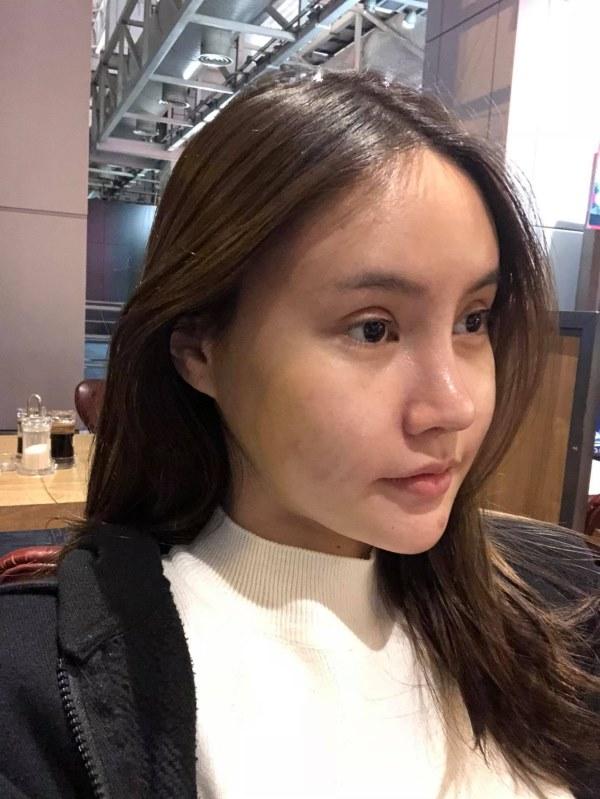 Chấp nhận đau đớn hàng tháng trời, cô gái từ vịt thành thiên nga-7