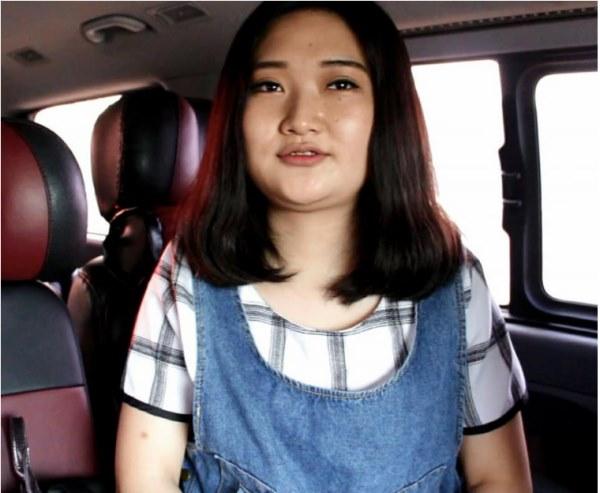 Chấp nhận đau đớn hàng tháng trời, cô gái từ vịt thành thiên nga-1