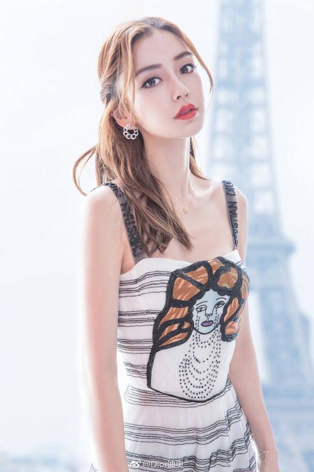 Angela Baby bị chê xuống sắc sau khi chỉnh răng sứ-11