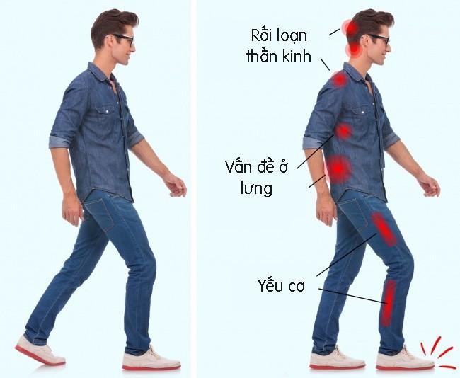 7 dáng vẻ khi đi bộ cảnh báo bạn đang bị bệnh-4