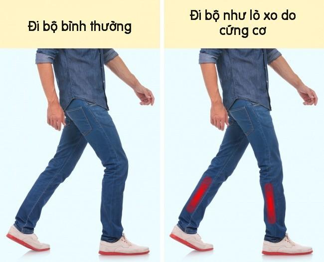 7 dáng vẻ khi đi bộ cảnh báo bạn đang bị bệnh-7