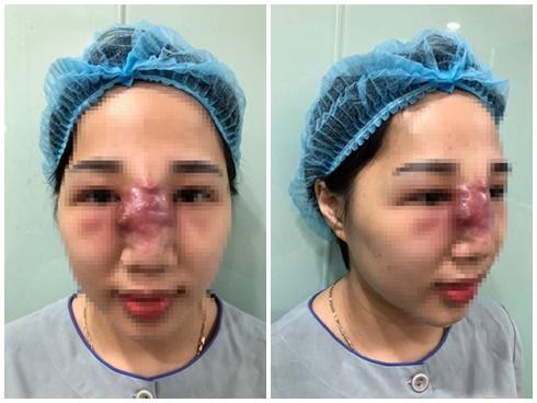 Đừng dại mà mặc chung quần áo với người khác bởi bạn có thể mắc phải hàng loạt vấn đề sau-5