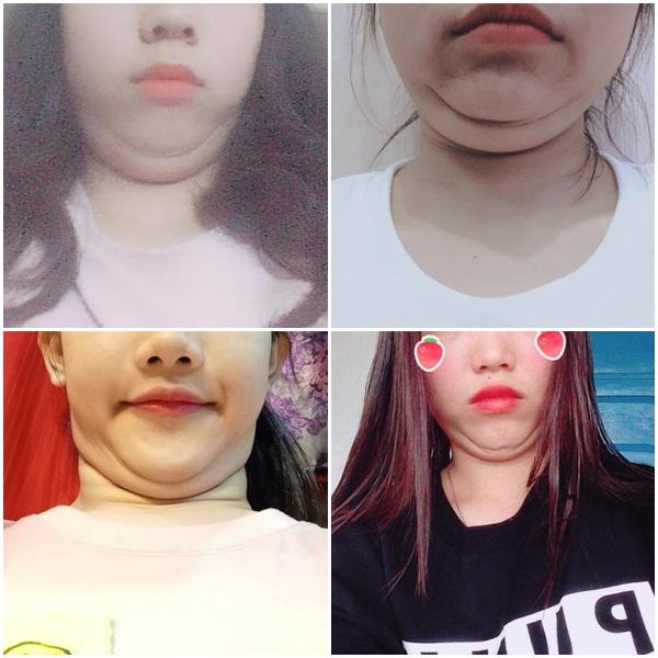 Phát cuồng với trào lưu cằm nọng, điển trai như Isaac cũng bất chấp xấu xí miễn sao hợp thời-9