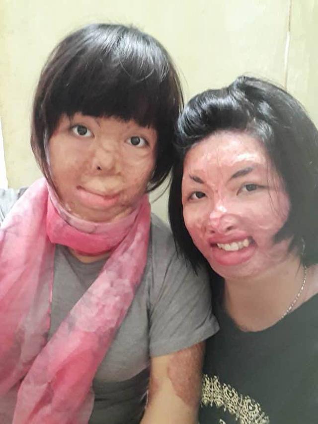 Hai người phụ nữ bị chồng tẩm xăng đốt nắm tay nhau tô hồng cuộc sống-1