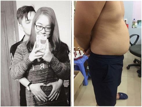 Anh chồng 9X bụng to chứng minh 'nghén hộ vợ là có thật'