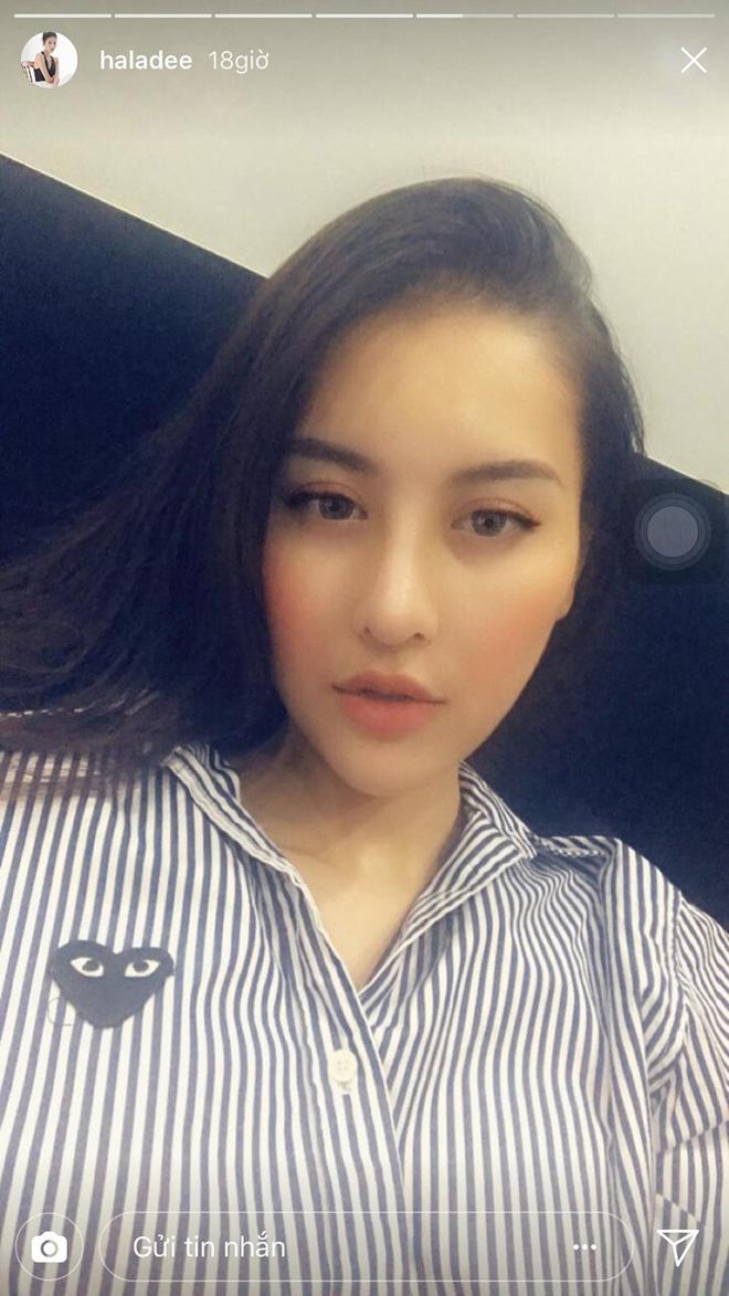 Gương mặt của Hà Lade ngày càng nhọn và dài giống hệt trào lưu thẩm mỹ mặt rắn-6