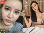 Vô tình tắt chế độ làm đẹp khi livestream, hot girl Trung Quốc lộ mặt thật gây shock