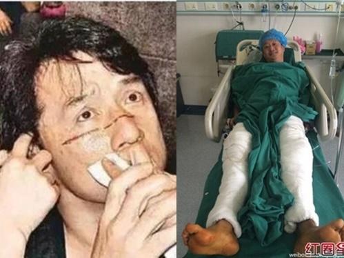 Sốc với nam diễn viên tự chặt cánh tay, giả thương binh để được đóng phim-4