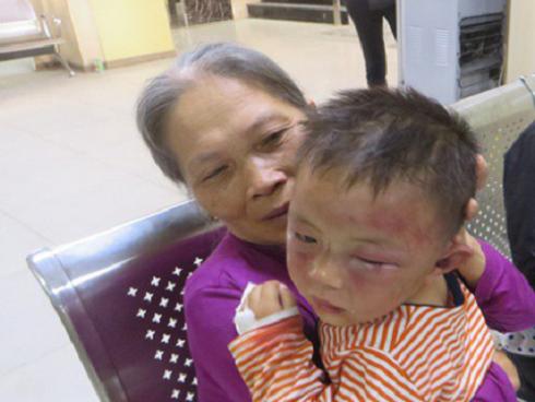 Cháu bé bị bố dượng bạo hành: Bác sĩ điều trị nói gì?