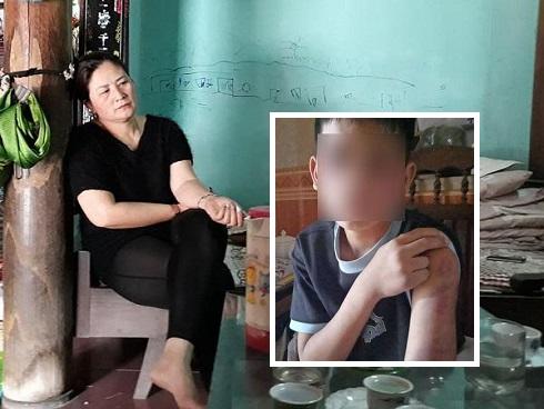 Bé trai 14 tuổi bị bố và mẹ kế đánh đập: Mẹ ruột sốc, không nhận ra con khi gặp