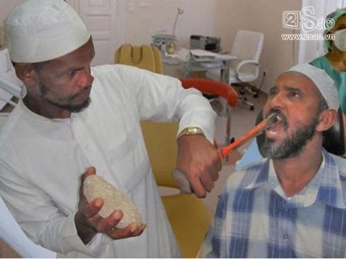 Những cách nhổ răng 'bá đạo' nhất trên thế giới