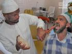 Những cách nhổ răng 'bá đạo' nhất trên thế giới
