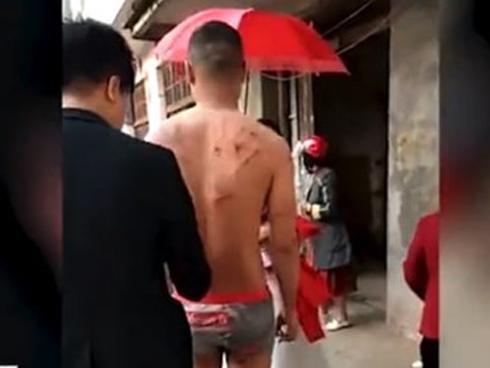 Chỉ vì hủ tục đám cưới, chú rể bị đánh đập, xát muối vết thương