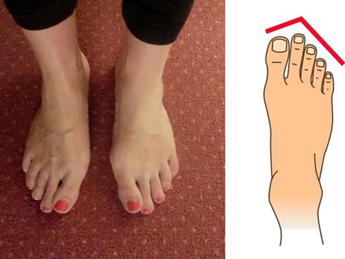 Nhìn xuống bàn chân mình xem chân bạn thuộc kiểu nào và tôi sẽ nói về bí mật tính cách con người bạn