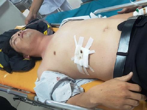 Lớp trưởng đâm thầy chủ nhiệm trọng thương vì bị yêu cầu xóa hình xăm