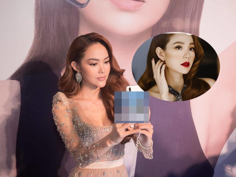 90 ngày đã trôi qua, chiếc cằm biến dạng của Minh Hằng vẫn chưa trở về đúng trạng thái trước khi bị botox hại-13