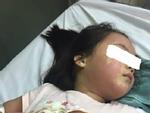 Cảnh báo: Bé gái 5 tuổi nổi mẩn khắp người sau khi uống trà sữa