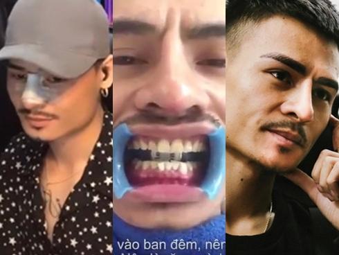 Đâu chỉ thừa nhận sửa mũi, 'hiện tượng mạng' Hoa Vinh còn tát tút hàm răng, lại xăm cả lông mày!