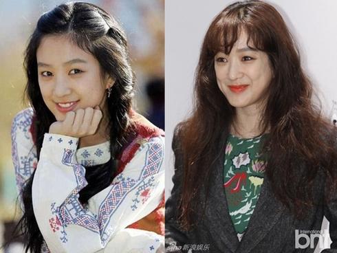 Những lần gây sốc đi vào lịch sử của sao Hàn vì dao kéo quá đà: Nhẹ thì kém sắc, nặng thì mặt biến dạng