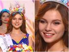 Vừa đăng quang, tân Hoa hậu Nga 2018 đã bị soi 'răng thưa như răng lược'