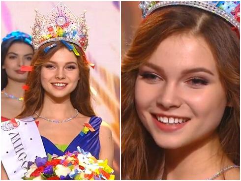 Vừa đăng quang, tân Hoa hậu Nga 2018 đã bị soi 'răng thưa như răng lược'
