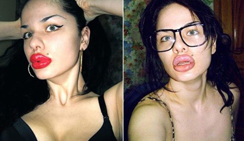 Đôi môi không hề phù hợp với tỉ lệ gương mặt là lỗi không ít người gặp phải.