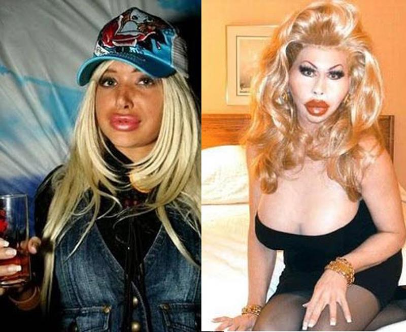 Tuy vậy, nhiều người lại cho rằng đôi môi quá khổ này gợi cảm và bơm không ngừng!