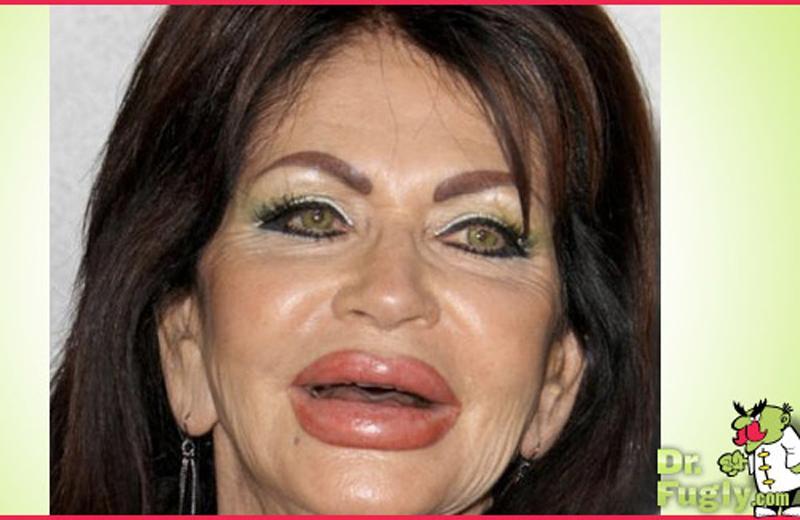 Người phụ nữ này thậm chí còn rất hài lòng với đôi môi hiện tại.