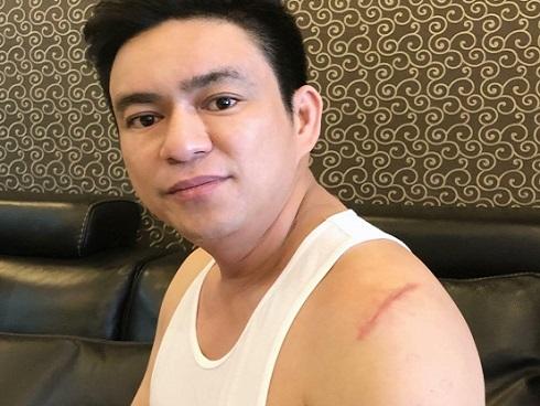 Bác sĩ Chiêm Quốc Thái bị nhóm người mang hung khí chém trọng thương ở phố đi bộ