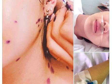 Bảo Anh huỷ hàng loạt show vì bệnh thuỷ đậu, sốt đến mất giọng