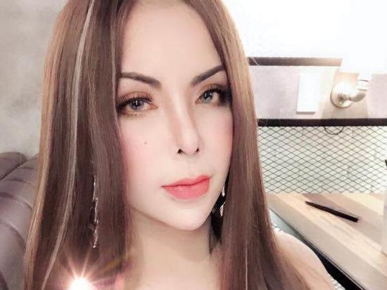 Sau biến chứng nạo silicone, hot girl chuyển giới triệu followers tiếp tục khoe ảnh sửa mũi!