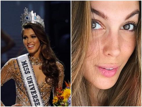 Dù là tuyệt sắc giai nhân, Hoa hậu Hoàn vũ Iris Mittenaere vẫn để lộ da mặt chi chít tàn nhang