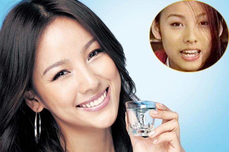 Lee Hyori trong quá khứ có hàm dưới khấp khểnh.