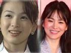 Không riêng gì Song Hye Kyo, nhiều Sao cũng thành mỹ nhân nhờ chỉnh răng
