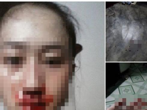 Con gái đau đớn 'tố' bị cha ruột đánh gãy xương mũi, máu chảy be bét cùng chuỗi ngày sống trong bạo hành