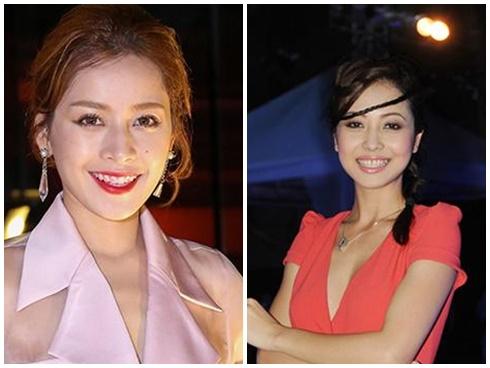 Những sao Việt ngượng chín mặt vì 'răng ăn son' và cách khắc phục sự cố này