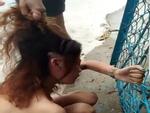 Bắc Giang: Vợ tố chồng nhẫn tâm dùng dao rạch nát mặt vợ vì ghen tuông-5