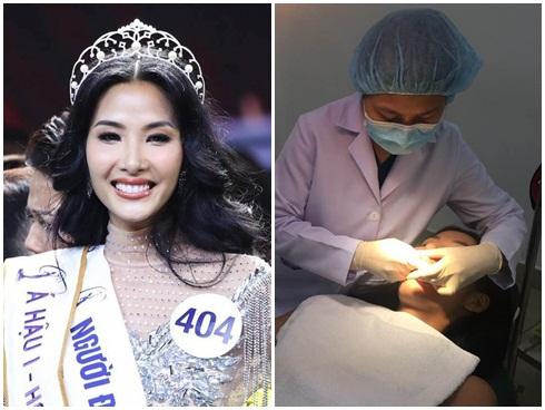 Nối gót H'Hen Niê, Hoàng Thùy đến gặp nha sĩ để tìm hàm răng hoàn hảo