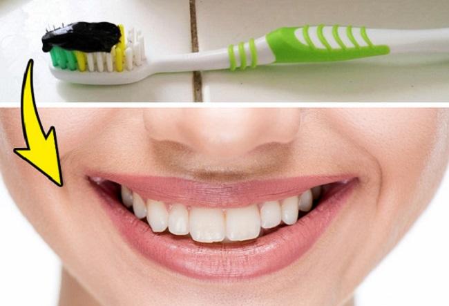 Làm trắng răng bằng than hoạt tính: Nghiền nát 1 viên than hoạt tính rồi trộn với nước thành hỗn hợp sền sệt, dùng bàn chải đánh răng bằng hỗn hợp này trong khoảng 5-10 phút rồi súc miệng thật sạch. Chỉ nên áp dụng phương pháp này 2 lần/ tuần vì than hoạt tính có tính bào mòn, tẩy trắng mạnh.